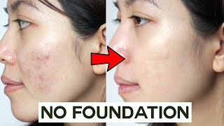 How to Cover Acne amp Blemishes WITHOUT Foundation • easy amp non cakey [upl. by Annoirb554]