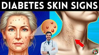 8 Skin Signs of Diabetes You Should Never Ignore [upl. by Ofori]