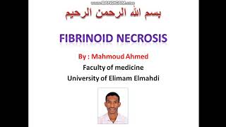 ١١ شرح ال Fibrinoid necrosis طبيبسودانيTSD [upl. by Sad]