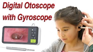 Digital Otoscope with Gyroscope Image Stabilization [upl. by Balthasar75]