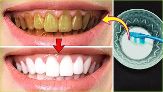 Whitening yellow teeth in just 3 minutes hydrogen peroxide with baking soda [upl. by Fitzgerald]