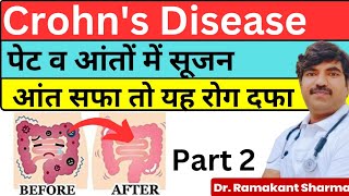 Crohns Disease Treatment  आंतो में सूजन  Inflammatory Bowel Disease Explaineddrramakantsharma7 [upl. by Lavinia466]