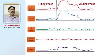 Urodynamic study of voiding phase of bladder [upl. by Starla]