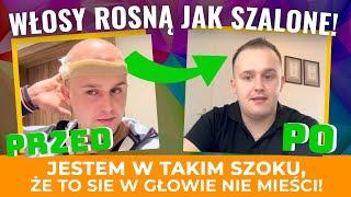 CUDA PO KTÓRYCH WŁOSY ROSNĄ JAK SZALONE❗️ [upl. by Clarine835]