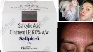 Salipic 6 Ointment Cream Salicylic Acid Ointment IP 60 ww [upl. by Aip]