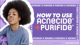 Get started with Acnecide benzoyl peroxide spot treatment What you need to know [upl. by Enelyar30]