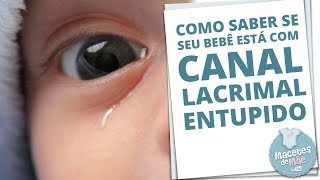 CANAL LACRIMAL ENTUPIDO E COMO TRATAR A OBSTRUÇÃO  MACETES DE MÃE [upl. by Ayik]