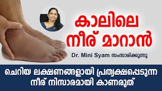 കാലിലെ നീര് നിസാരമായി കാണരുത്  Malayalam Health Tips [upl. by Ynnattirb129]