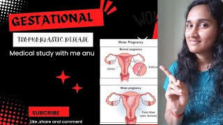 Gestational trophoblastic disease part1 molar pregnancy pathology molarpregnancy [upl. by Elwee213]