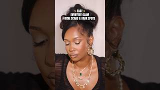 ✨EASY✨DEWY SOFT GLAM Acne scars amp Hyperpigmemtation 90smakeup makeupforblackwomen [upl. by Ilek]