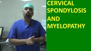 What is Cervical spondylosis Cervical Spinal cord compression and Myelopathy मानेचा संधिवात [upl. by Boigie874]