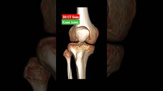 Tibial and Sural Nerve Glide Courtside [upl. by Monjan904]