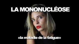 JAI EU LA MONONUCLÉOSE  LA MALADIE DU BAISER [upl. by Ney]