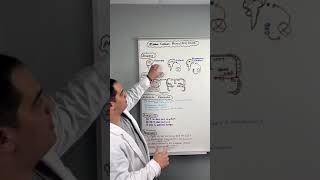 Ischemic Stroke  Middle Cerebral Artery Stroke MCA shorts [upl. by Gibb]