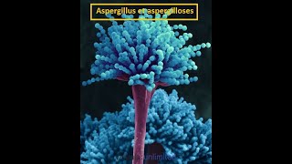 Parasitologie Lexplication la plus facile de laspargillose [upl. by Fedak]