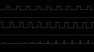 Diode Dynamics AY38910 [upl. by Ateekram]