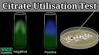 Citrate Utilzation Test  IMViC Test  Simmons Citrate Agar Test  Citrate Test  Simmons Agar [upl. by Asaert]