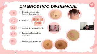 Queratosis Actinica Mabel Carolina Fernandez Alanes 25847 [upl. by Godbeare248]