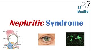 Nephritic Syndrome  Clinical Presentation Causes and Treatment [upl. by Ahteral]