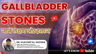 Gallbladder Stones Disease Symptoms amp Treatment  Dr Vijayant Sachan [upl. by Amalee]