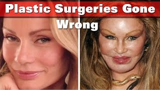 Models  Fasion Designers  Singers amp More Whose Plastic Surgeries Gone Wrong [upl. by Ordnassela]