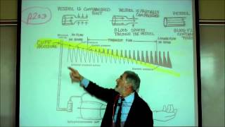 CARDIAC PHYSIOLOGY PART 4 by Professor Finkwmv [upl. by Ferrell]