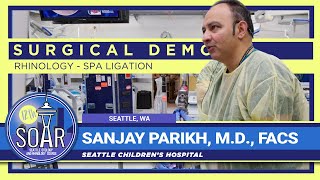 Surgical Demo SPA Ligation  Sanjay Parikh MD [upl. by Benedix453]