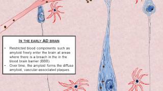 Alternative Hypothesis of Neuronal Death in Alzheimers disease [upl. by Hawkins56]