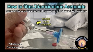 CataractCoach™ 1664 how to filter triamcinolone acetonide Kenalog [upl. by Erodroeht]