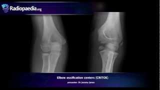 How to use Radiopaedia to teach [upl. by Enyrhtac]