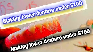 Making Lower Dentures Under 100 Dollars [upl. by Sualocin]