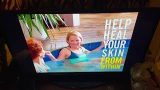 Dupixent Eczema TV Commercial  One Step Ahead May 2021 [upl. by Enela]