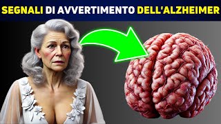 SCIENTIFICO Queste 5 Abitudini Sono Legate allAlzheimer [upl. by Nolyaw385]