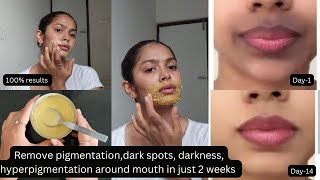 2 home remedies to remove dark spotsdark black patches pigmentation around mouth  100 results [upl. by Romelle]