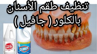 تنظيف طقم الاسنان المتحرك بالكلور  جافيل  المبيضNettoyage de prothèse dentaire amovible avec Javel [upl. by Weisbrodt]