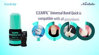 Kuraray CLEARFIL Universal Bond Quick [upl. by Dlorrej471]