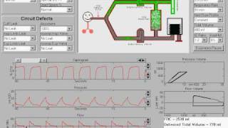 Introduction to BreathSim anesthesia simulations  with narration [upl. by Stedman]