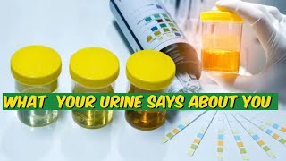 quotFoamy Urine and Color Changes Should You Be Concernedquot [upl. by Willi]