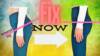 Anterior Pelvic Tilt FIX  No more Lower back Pain and Protruding Belly [upl. by Zoubek]