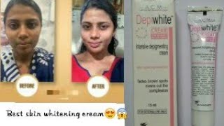 depiwhite cream review and uses skinlighteningcream [upl. by Lori502]