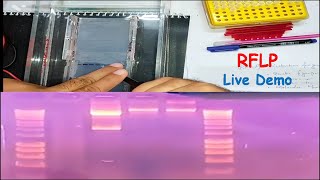 RFLP  Restriction Fragment Length Polymorphism LIVE DEMO [upl. by Platt]