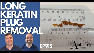 LONG KERATIN PLUG REMOVAL  EP915 [upl. by Lorant319]