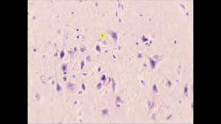 Multipolar interneuron neuron oligodendrocytes Cerebrum HampE [upl. by Davie]