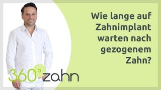 Wie lange auf Zahnimplantat warten nach gezogenem Zahn  Implantate  Fragen amp Antworten  360°zahn [upl. by Renate]