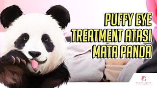 PUFFY EYE TREATMENT atasi Mata Panda [upl. by Cinelli]