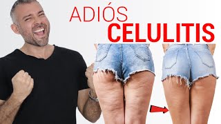 Como Eliminar La CELULITIS en 4 Simples Pasos [upl. by Estey792]