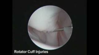 Gulf Coast Veterinary Surgery Shoulder Arthroscopy [upl. by Kessia613]