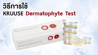 KRUUSE Dermatophyte test  By BEC [upl. by Fife]