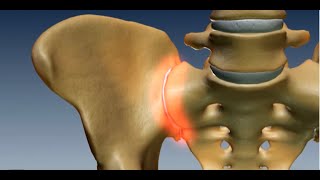 Where is the Sacroiliac Joint Anatomy of the Sacroiliac Joint [upl. by Aldwon]