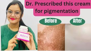 बिना स्किन छिले pigmentation melasma ठीक करे इस क्रीम से  xerina cream [upl. by Baily611]